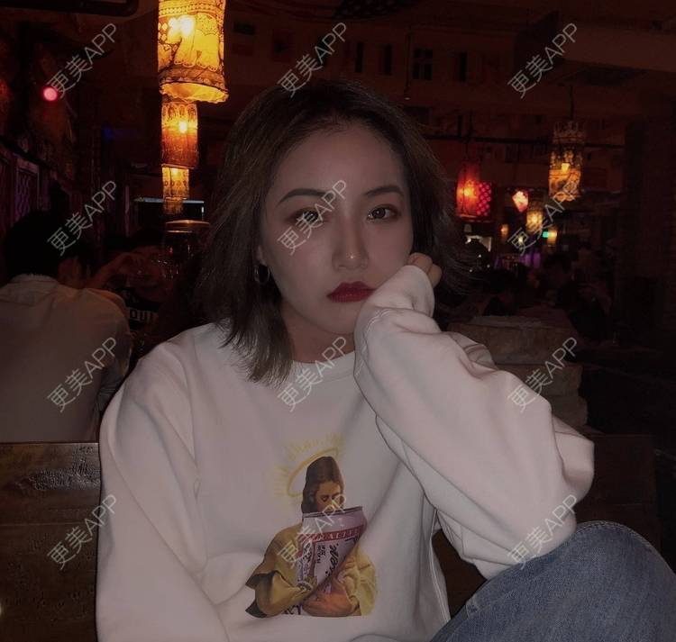 更美 - 誠意ナ到吃卟消ξ细的注射溶脂瘦脸经验 | 北京 | 注射溶脂瘦脸