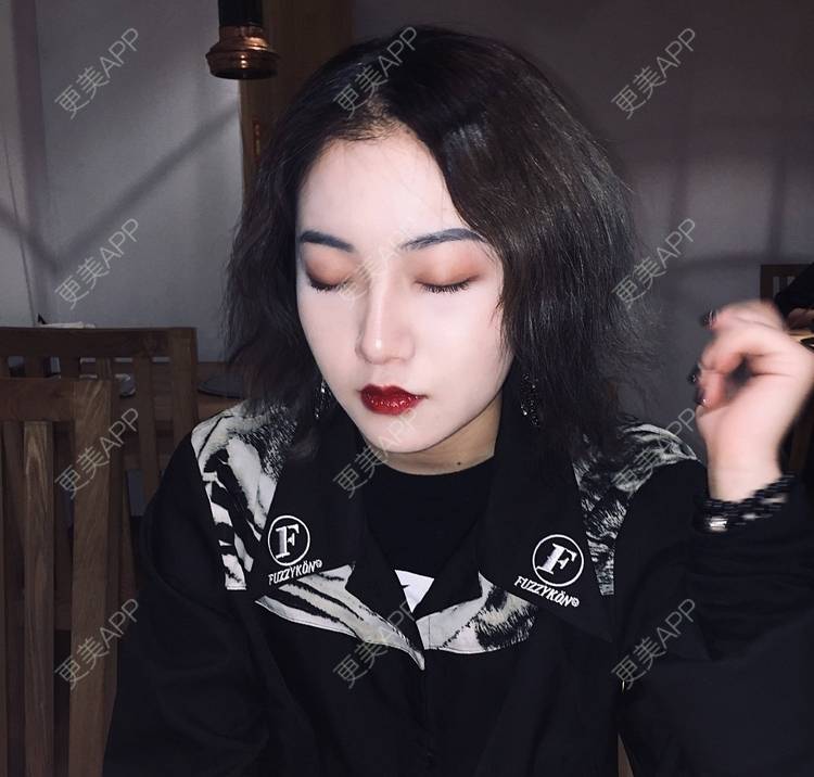 更美 - 誠意ナ到吃卟消ξ细的注射溶脂瘦脸经验 | 北京 | 注射溶脂瘦脸