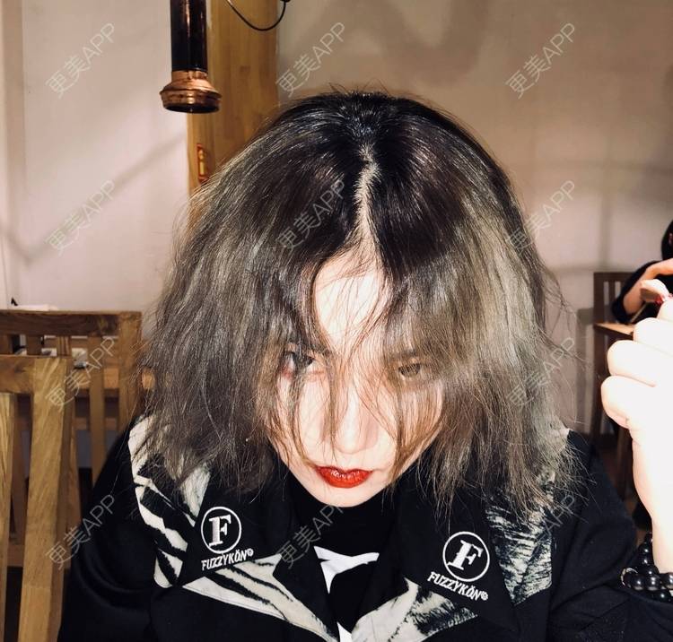 更美 - 誠意ナ到吃卟消ξ细的注射溶脂瘦脸经验 | 北京 | 注射溶脂瘦脸