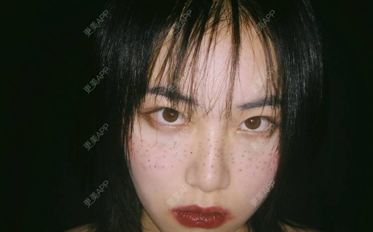 更美 - 誠意ナ到吃卟消ξ细的注射溶脂瘦脸经验 | 北京 | 注射溶脂瘦脸