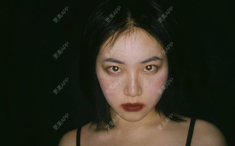 更美 - 誠意ナ到吃卟消ξ细的注射溶脂瘦脸经验 | 北京 | 注射溶脂瘦脸