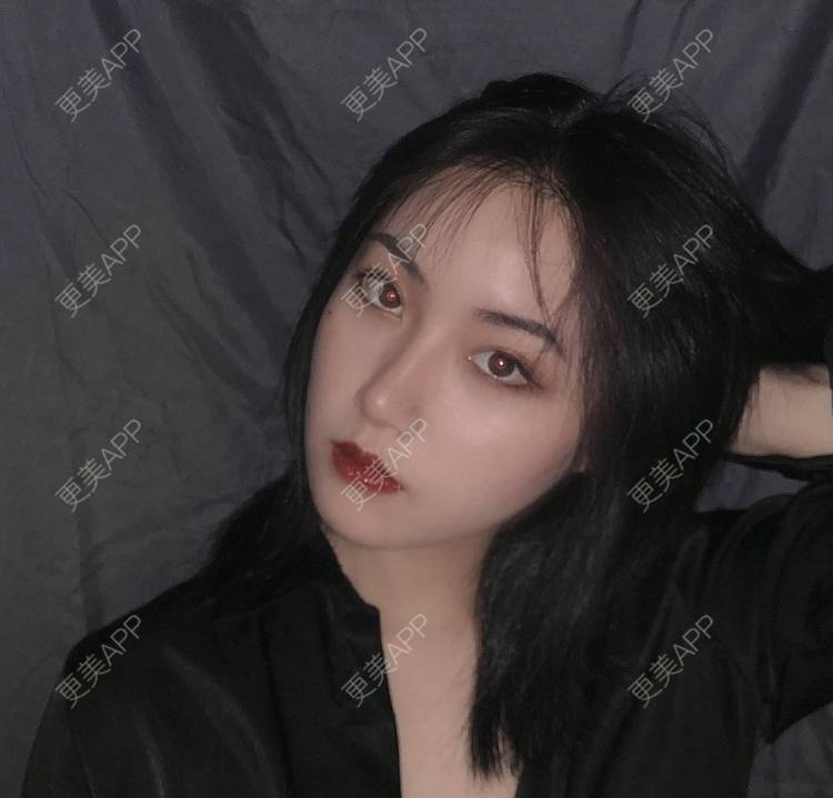 更美 - 誠意ナ到吃卟消ξ细的注射溶脂瘦脸经验 | 北京 | 注射溶脂瘦脸