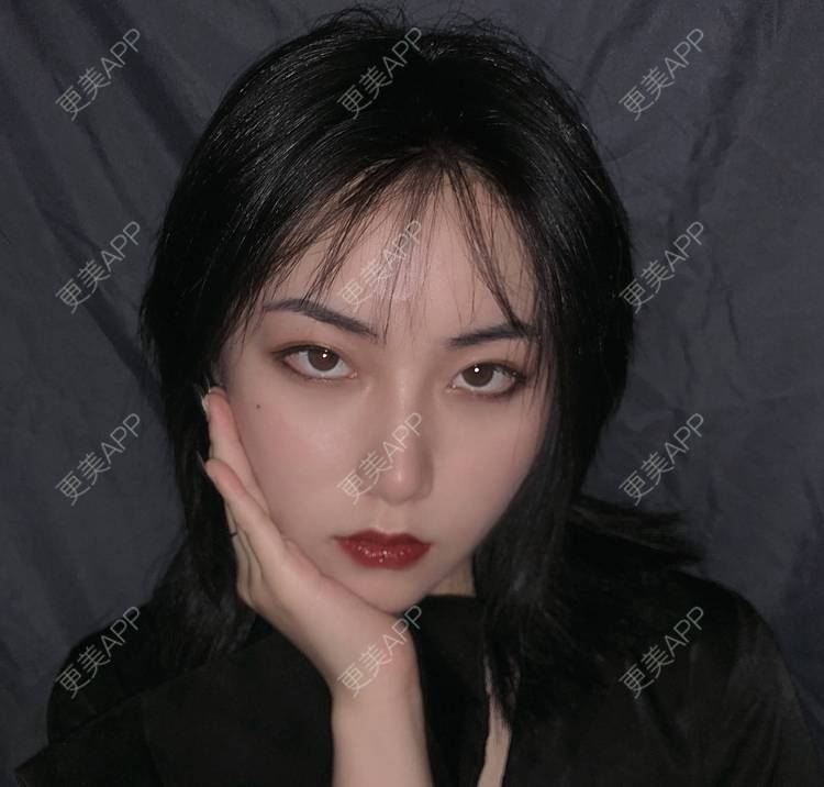 更美 - 誠意ナ到吃卟消ξ细的注射溶脂瘦脸经验 | 北京 | 注射溶脂瘦脸