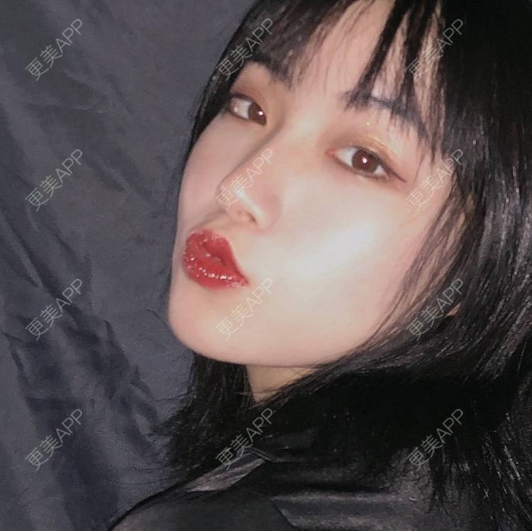 更美 - 誠意ナ到吃卟消ξ细的注射溶脂瘦脸经验 | 北京 | 注射溶脂瘦脸