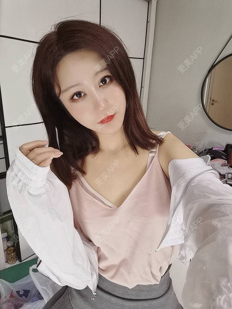 更美 - 素、颜╮浪的鼻形态修复经验 | 鼻形态修复 | 南京