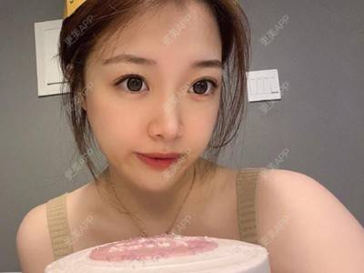 更美 - 更美用户OIhJ2NKalr的除皱套餐经验 | 除皱套餐