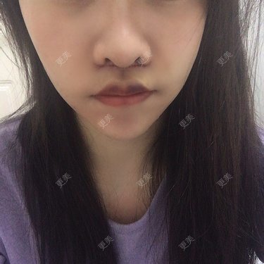 阿狸的城堡🏰
