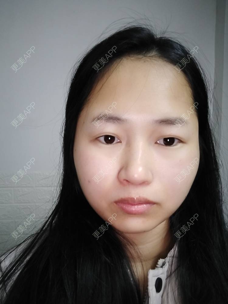 更美 - 小桃桃源的清洁水光补水经验 | 皮肤综合管理套餐 | 广州 | 清洁水光补水