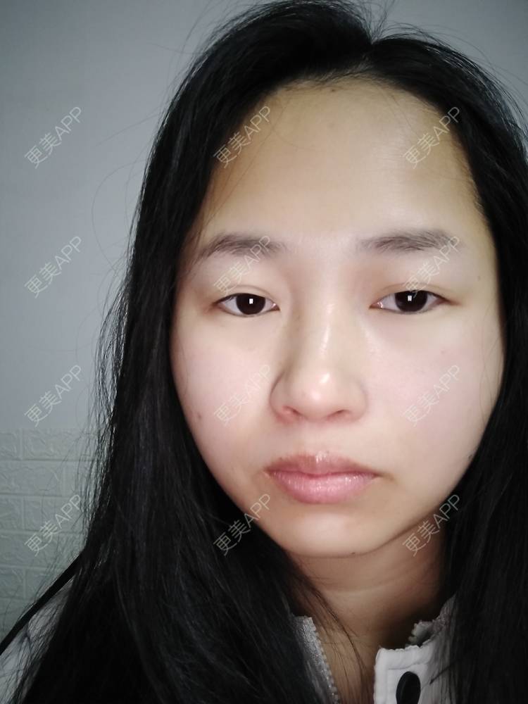 更美 - 小桃桃源的清洁水光补水经验 | 皮肤综合管理套餐 | 广州 | 清洁水光补水