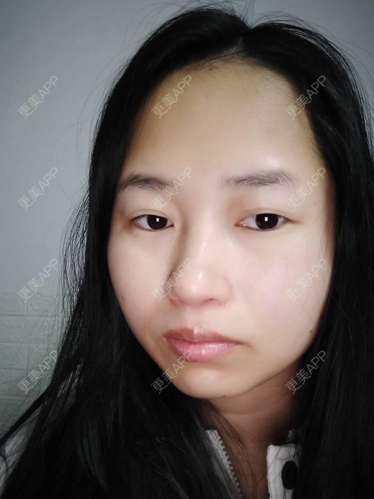更美 - 小桃桃源的清洁水光补水经验 | 皮肤综合管理套餐 | 广州 | 清洁水光补水