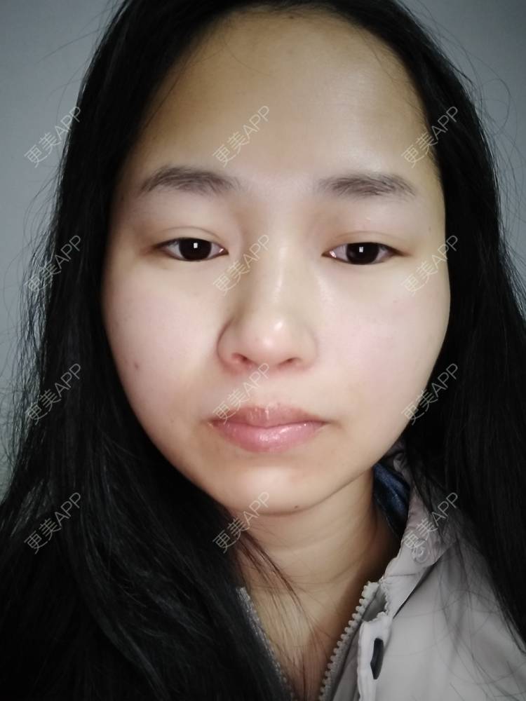更美 - 小桃桃源的清洁水光补水经验 | 皮肤综合管理套餐 | 广州 | 清洁水光补水