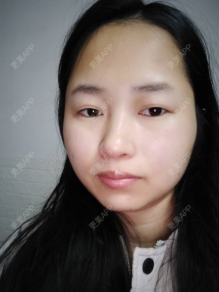 更美 - 小桃桃源的清洁水光补水经验 | 皮肤综合管理套餐 | 广州 | 清洁水光补水