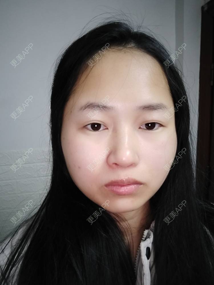 更美 - 小桃桃源的清洁水光补水经验 | 皮肤综合管理套餐 | 广州 | 清洁水光补水