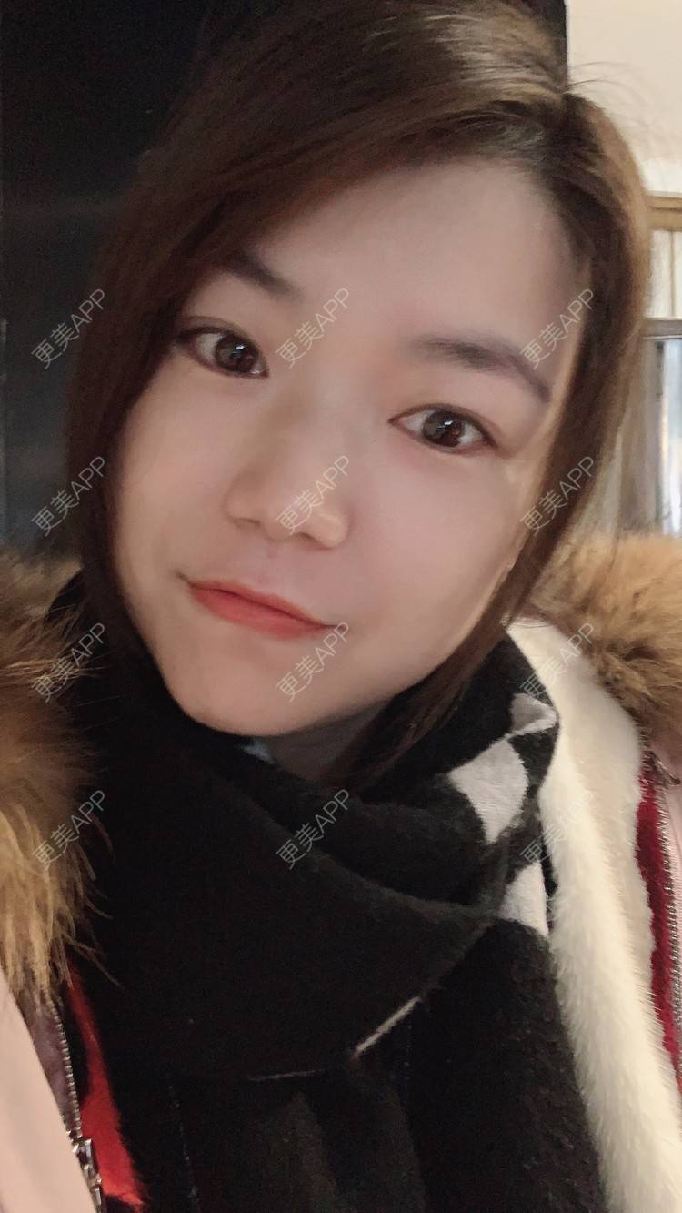 更美 - 小白蠢蠢的热玛吉经验 | 上海 | 热玛吉