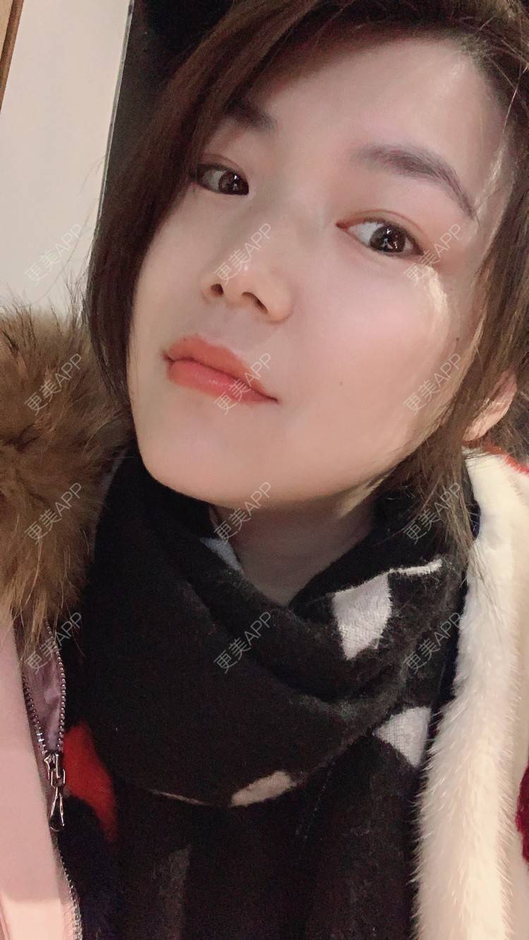 更美 - 小白蠢蠢的热玛吉经验 | 上海 | 热玛吉