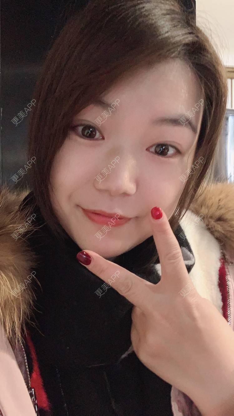 更美 - 小白蠢蠢的热玛吉经验 | 上海 | 热玛吉
