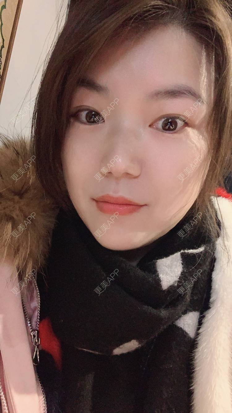 更美 - 小白蠢蠢的热玛吉经验 | 上海 | 热玛吉