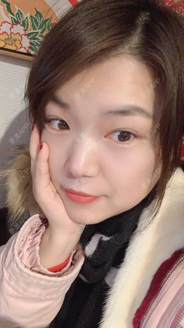 更美 - 小白蠢蠢的热玛吉经验 | 上海 | 热玛吉