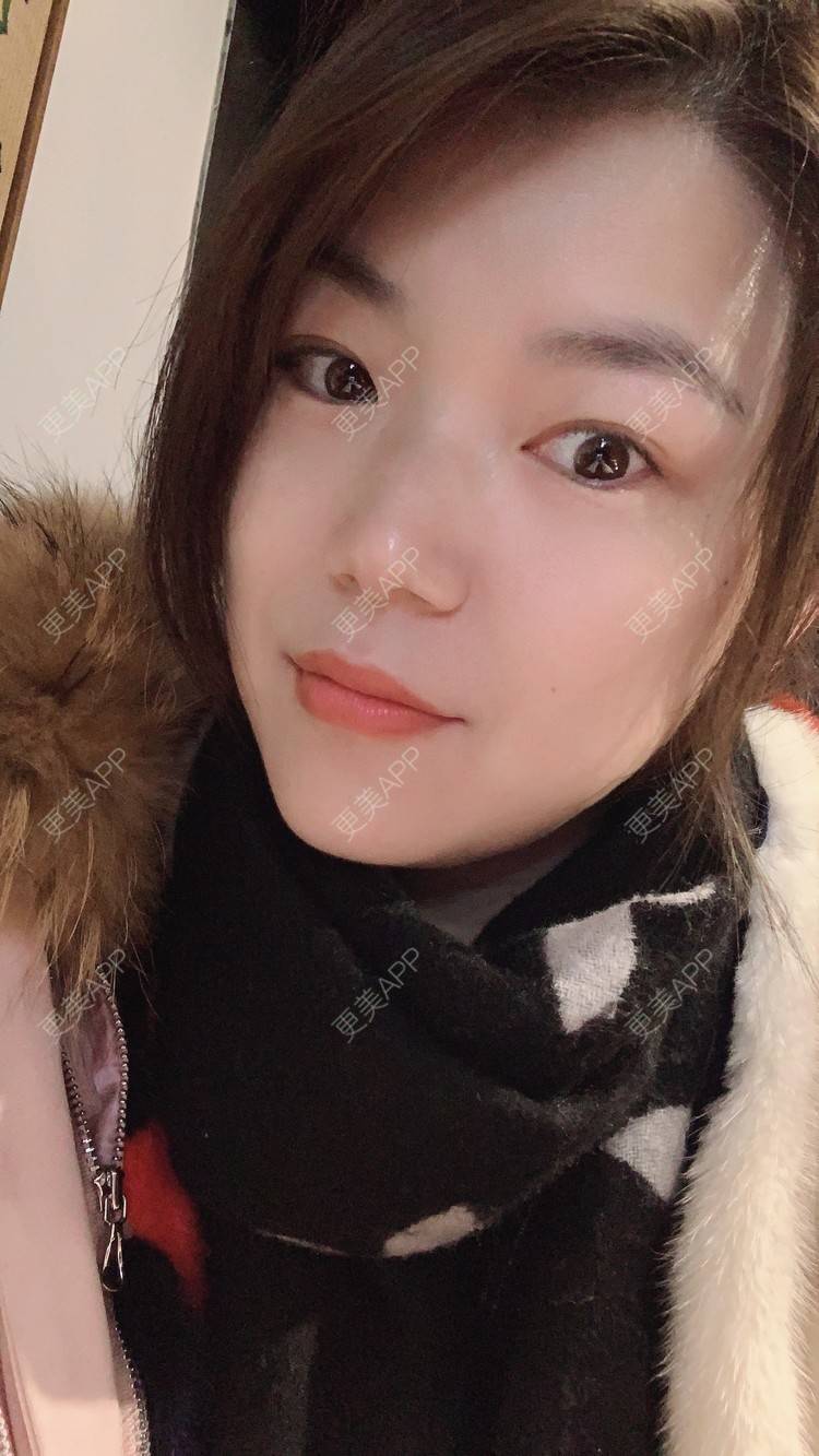 更美 - 小白蠢蠢的热玛吉经验 | 上海 | 热玛吉