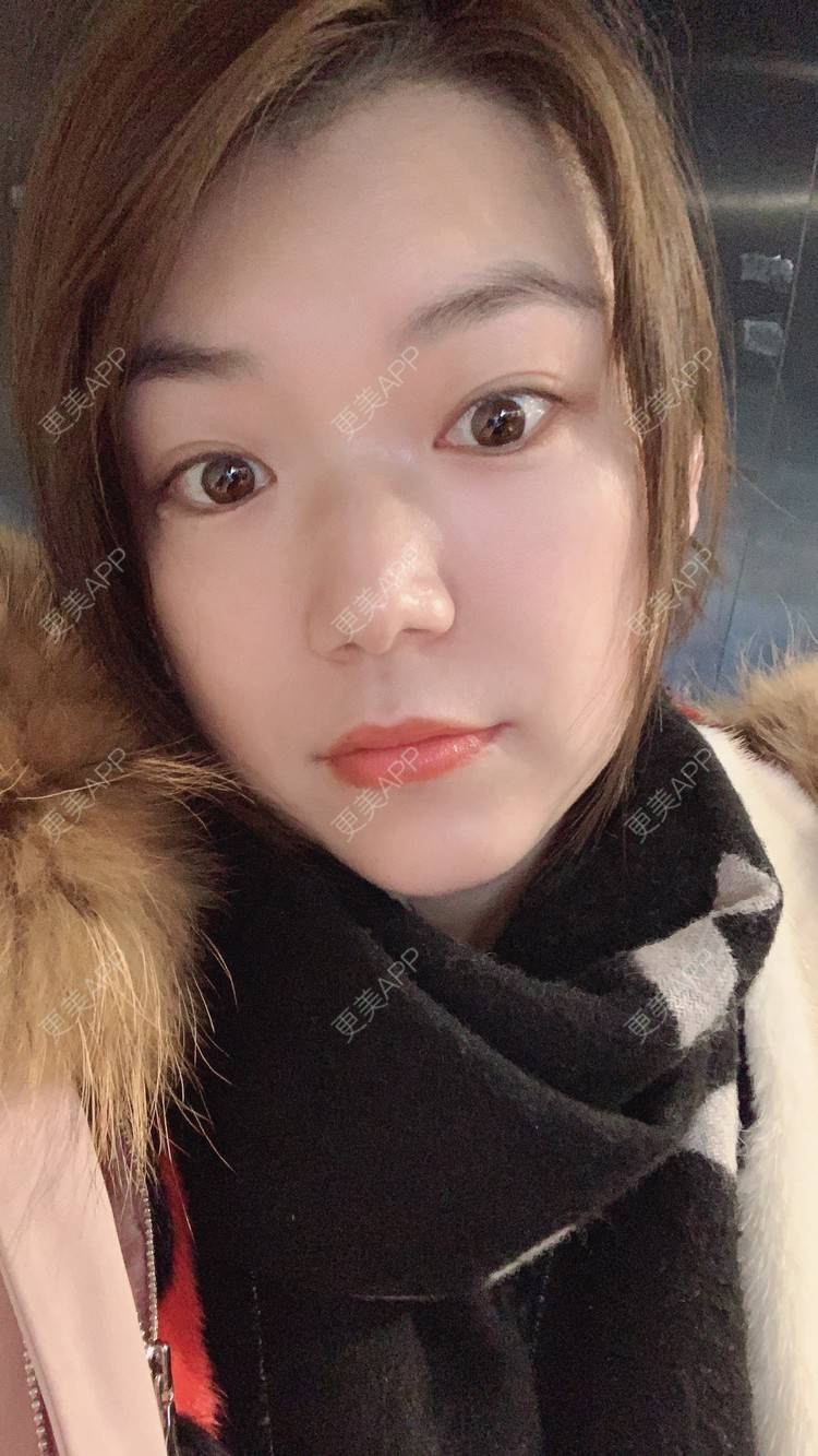更美 - 小白蠢蠢的热玛吉经验 | 上海 | 热玛吉