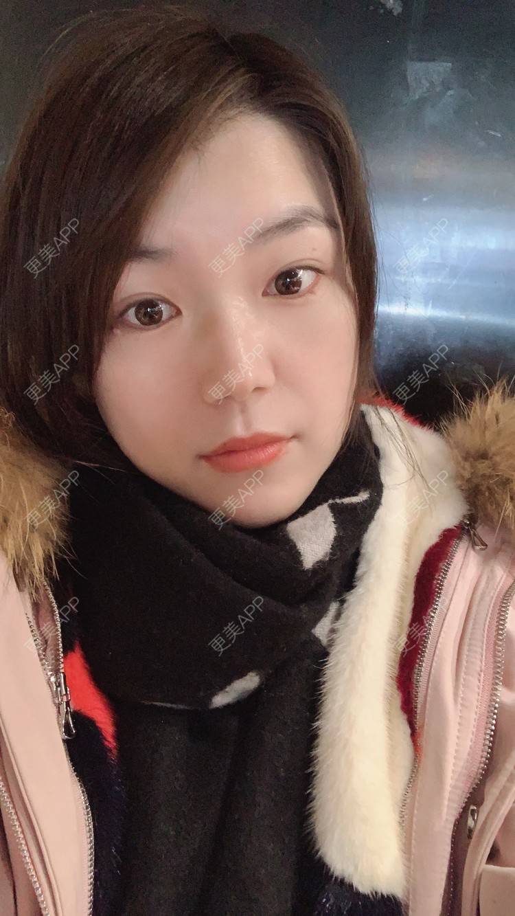 更美 - 小白蠢蠢的热玛吉经验 | 上海 | 热玛吉
