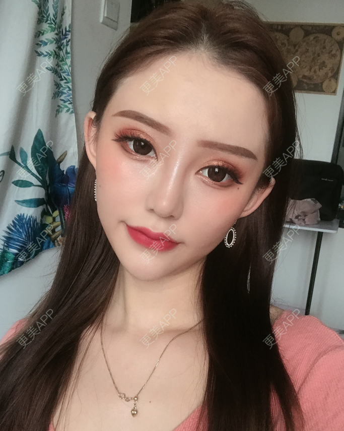 更美 - 更美用户fHTaaDv4A5的玻尿酸唇部经验 | 玻尿酸唇部 | 视频日记