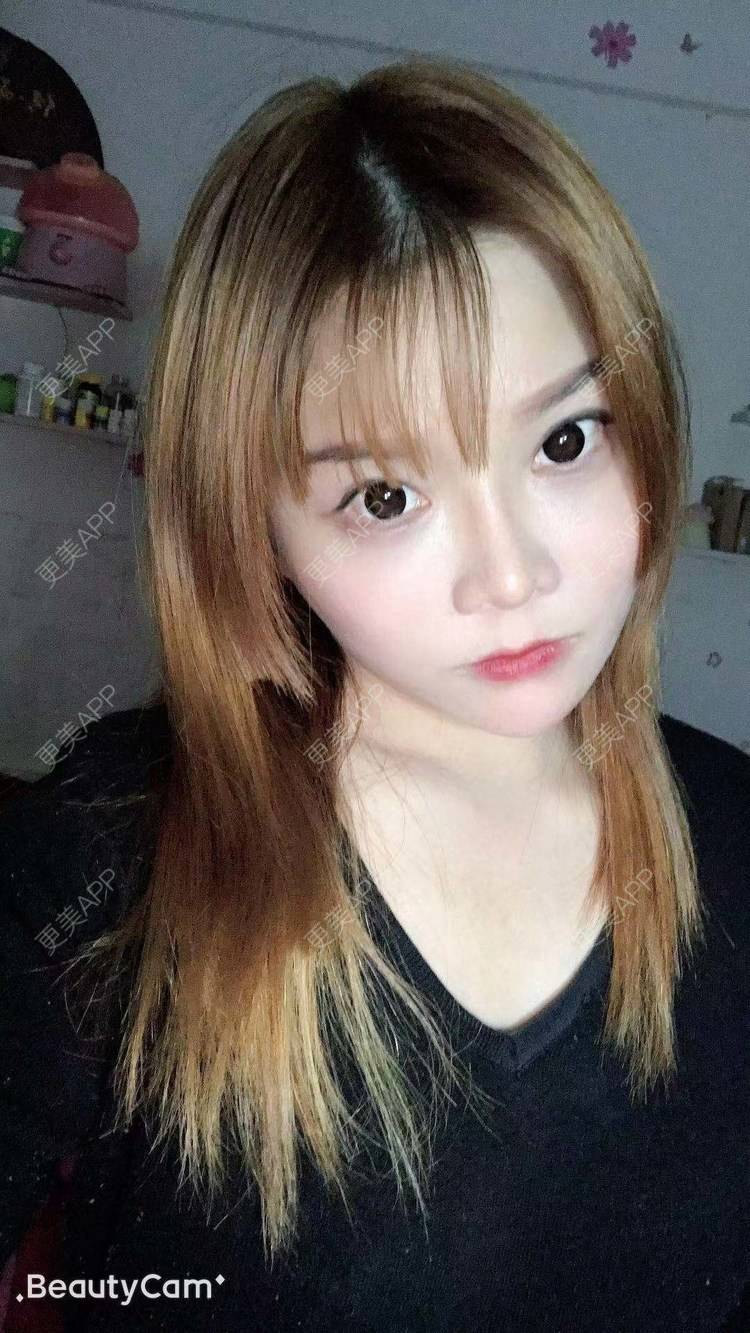 更美 - 小小小迷妹的吸脂瘦脸经验 | 吸脂瘦脸 | 双下巴吸脂 | 深圳