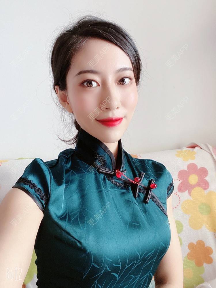 更美 - 富力小姐姐的射频溶脂瘦脸经验 | 北京 | 射频提升 | 射频溶脂瘦脸