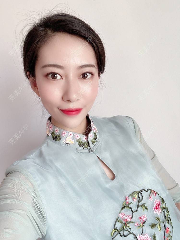 更美 - 富力小姐姐的射频溶脂瘦脸经验 | 北京 | 射频提升 | 射频溶脂瘦脸