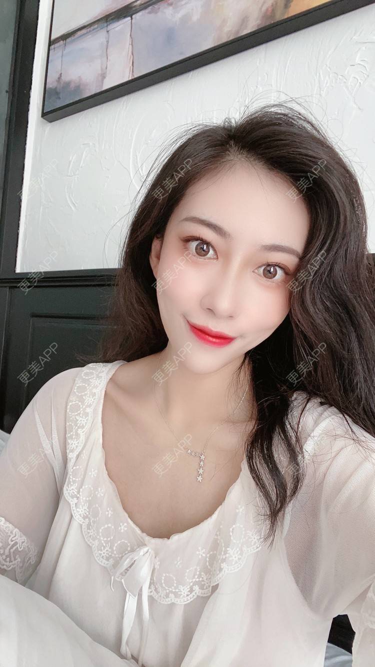 更美 - 富力小姐姐的射频溶脂瘦脸经验 | 北京 | 射频提升 | 射频溶脂瘦脸