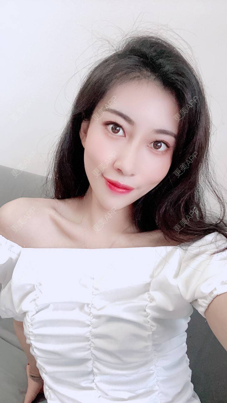 更美 - 富力小姐姐的射频溶脂瘦脸经验 | 北京 | 射频提升 | 射频溶脂瘦脸