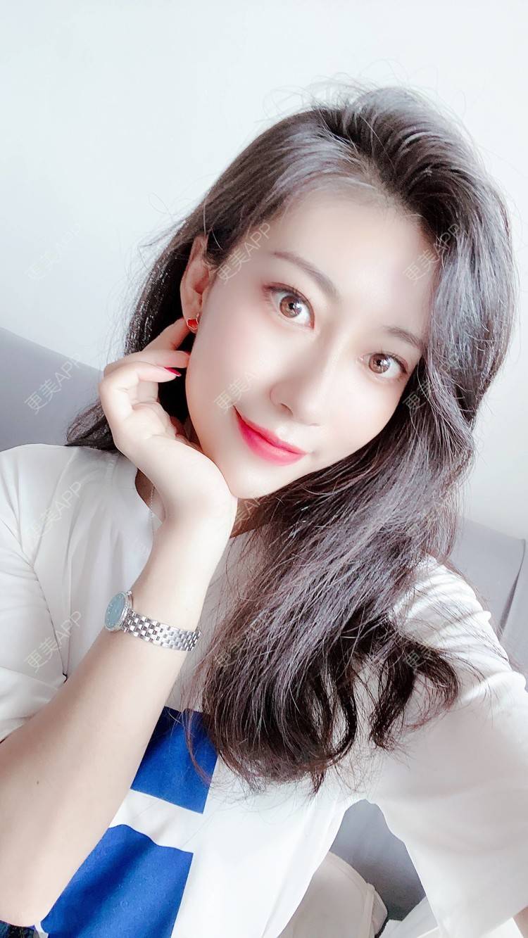 更美 - 富力小姐姐的射频溶脂瘦脸经验 | 北京 | 射频提升 | 射频溶脂瘦脸