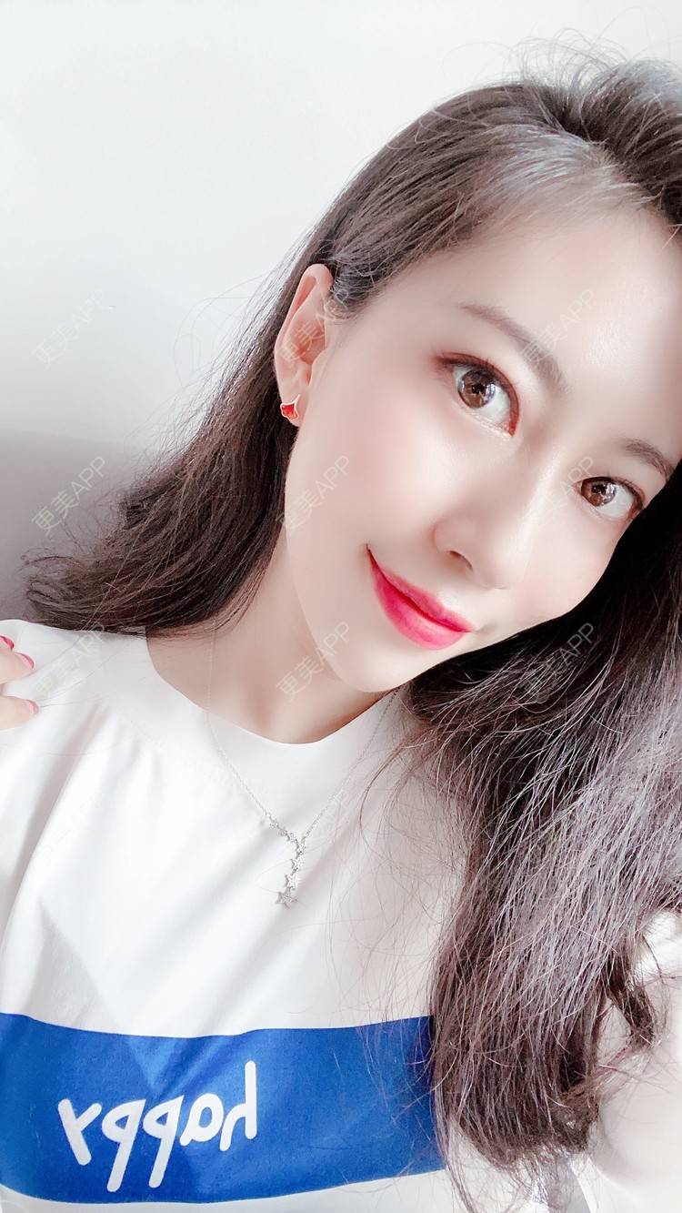 更美 - 富力小姐姐的射频溶脂瘦脸经验 | 北京 | 射频提升 | 射频溶脂瘦脸