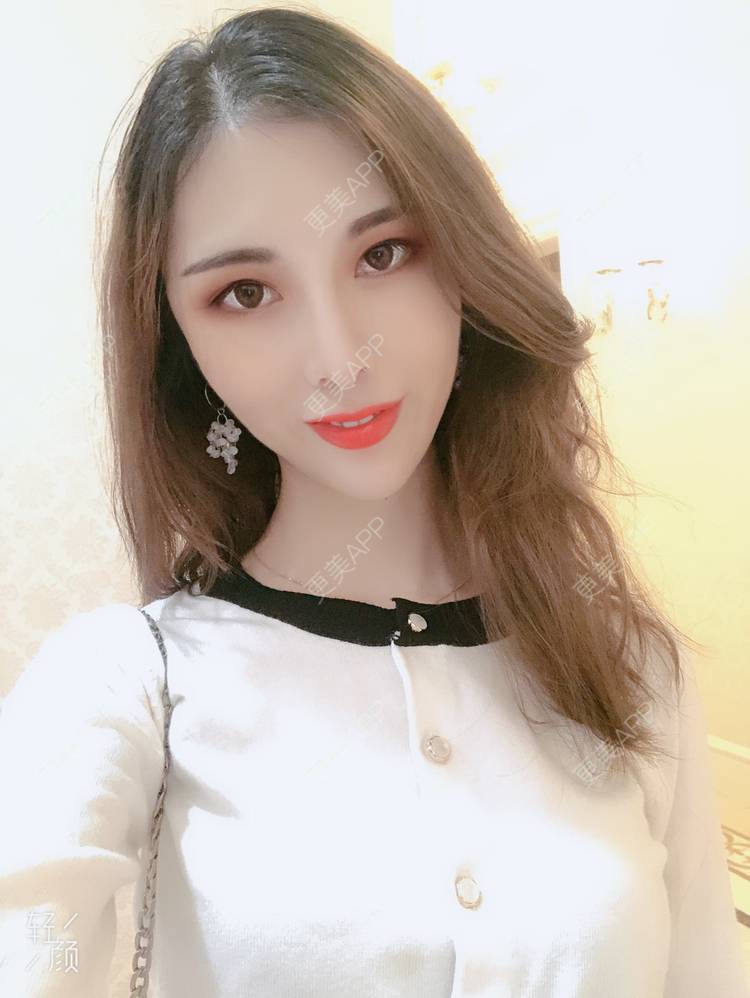 更美 - 十年饮冰劝的自体脂肪丰苹果肌经验 | 自体脂肪全面部填充 | 自体脂肪丰面颊 | 自体脂肪丰太阳穴 | 硅胶丰太阳穴 | 膨体丰太阳穴 | 自体脂肪丰额头 | 硅胶丰额头 | 自体脂肪丰苹果肌 | 膨体垫下巴 | 硅胶垫下巴 | 南宁