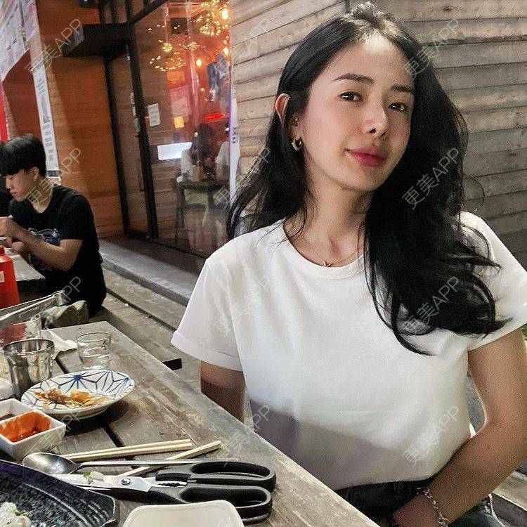 更美 - 更美用户P1jLDXh3gF的玻尿酸唇部经验 | 玻尿酸唇部