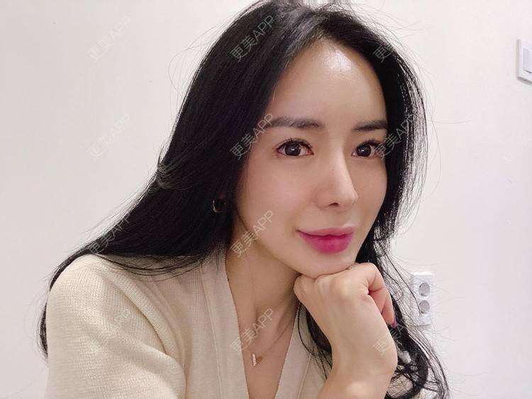 更美 - 更美用户P1jLDXh3gF的玻尿酸唇部经验 | 玻尿酸唇部
