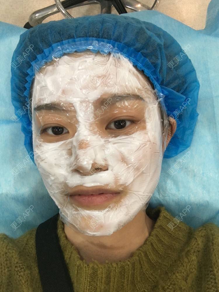 更美 - 更美用户cB5ajb4xmU的美白套餐经验 | 成都 | 美白套餐