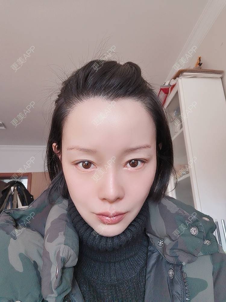 更美 - 🐷🐮仔仔仔的热玛吉经验 | 热玛吉 | 上海