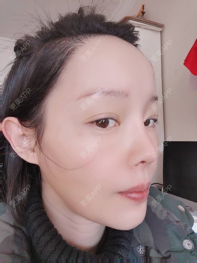 更美 - 🐷🐮仔仔仔的热玛吉经验 | 热玛吉 | 上海