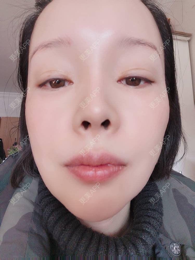 更美 - 🐷🐮仔仔仔的热玛吉经验 | 热玛吉 | 上海