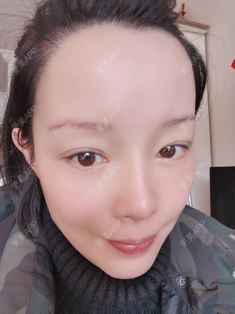 更美 - 🐷🐮仔仔仔的热玛吉经验 | 热玛吉 | 上海