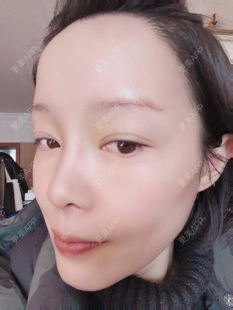更美 - 🐷🐮仔仔仔的热玛吉经验 | 热玛吉 | 上海