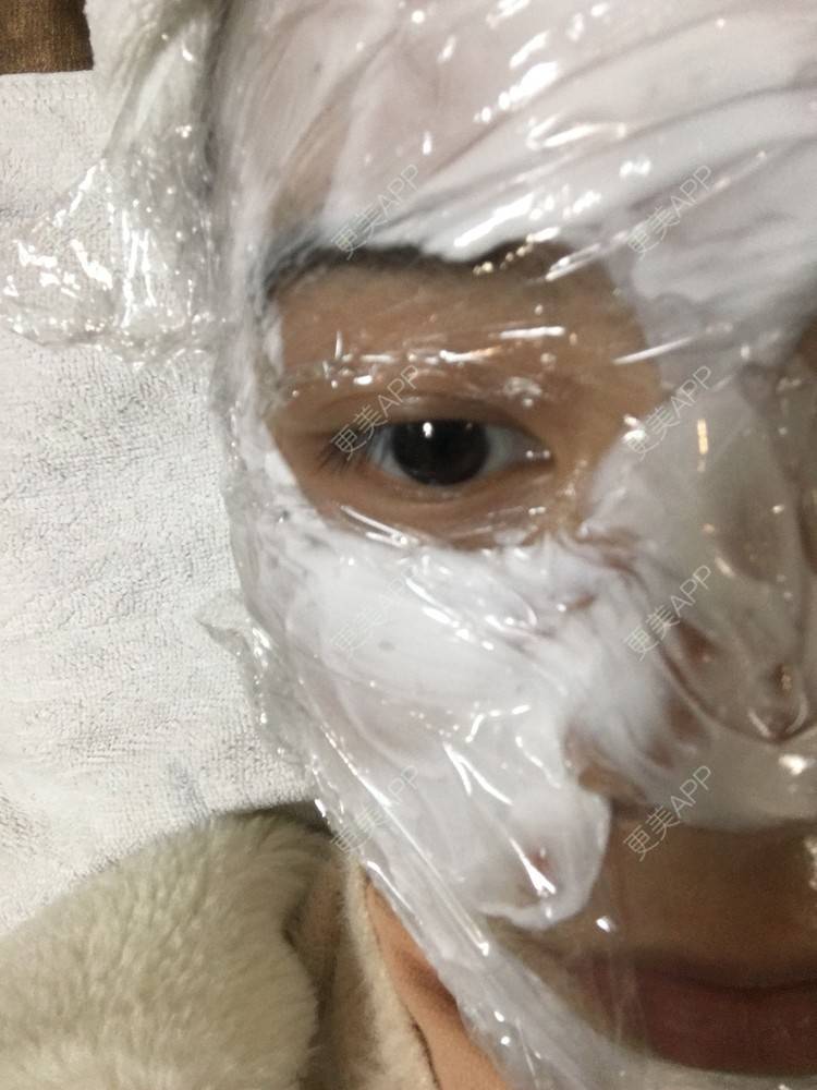 更美 - 更美用户cB5ajb4xmU的美白套餐经验 | 成都 | 美白套餐