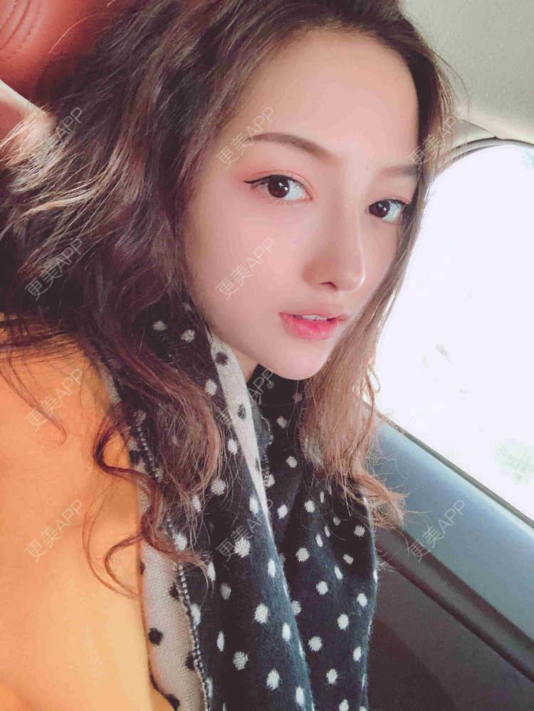 更美 - 佳人人家的鼻部多项经验 | 视频日记 | 鼻部多项 | 重庆