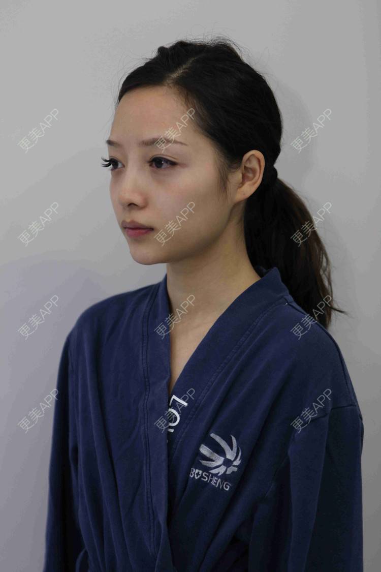 更美 - 佳人人家的鼻部多项经验 | 视频日记 | 鼻部多项 | 重庆