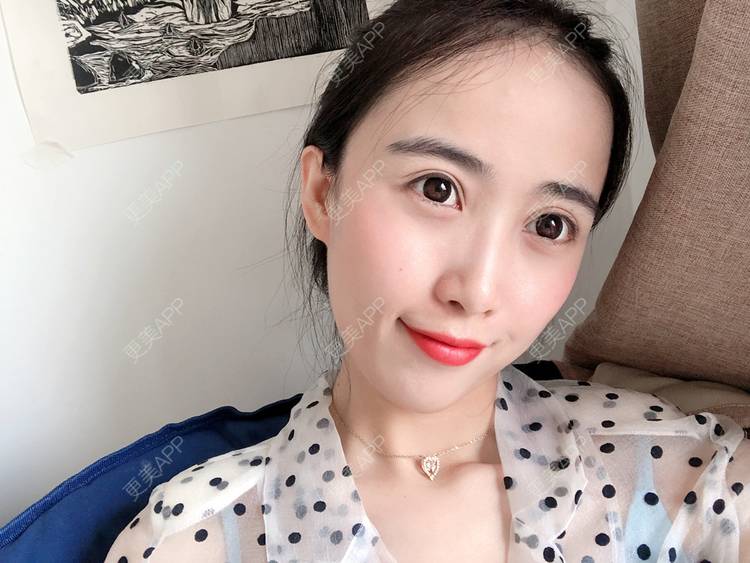 更美 - 更美用户4J9IrOAAYI的热拉提经验 | 热拉提