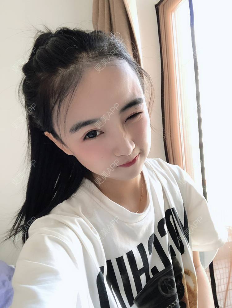 更美 - 更美用户4J9IrOAAYI的热拉提经验 | 热拉提