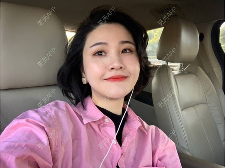 更美 - 更美用户H3fccyUbwD的玻尿酸面颊经验 | 上海 | 玻尿酸面颊