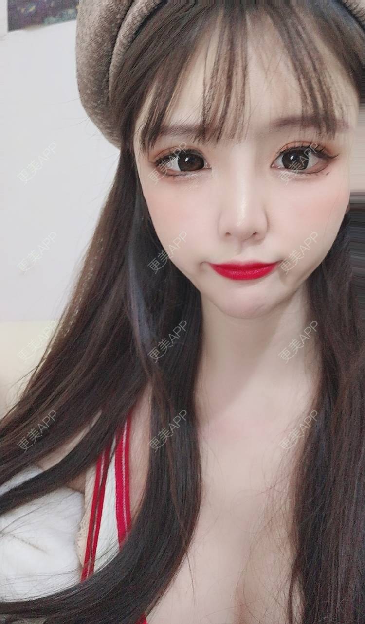 更美 - 晴天baby的假体隆胸经验 | 假体隆胸 | 郑州