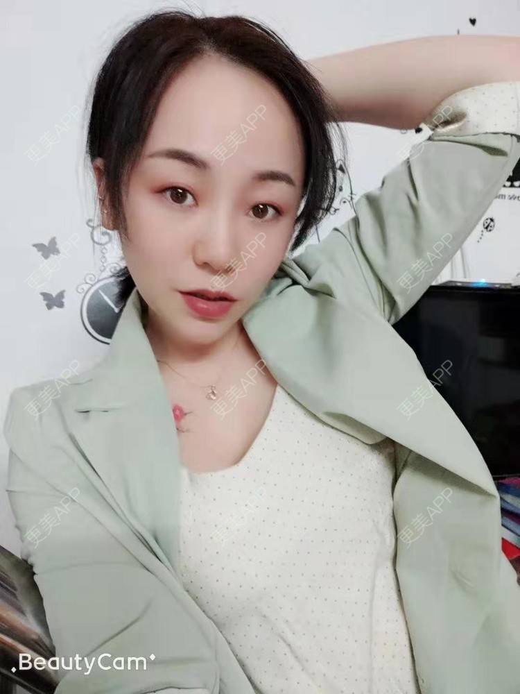 更美 - 生活小甜的腰腹吸脂经验 | 视频日记 | 泉州 | 腰部吸脂
